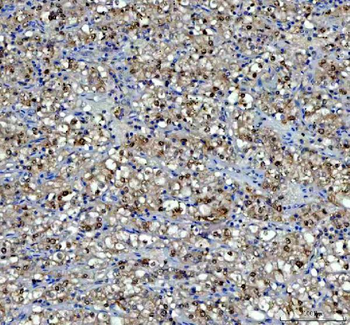 Anti-P15RS/RPRD1A Antibody