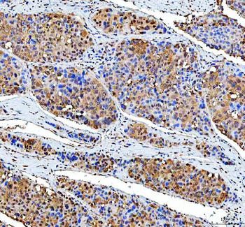 Anti-P15RS/RPRD1A Antibody