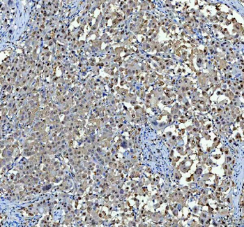 Anti-P15RS/RPRD1A Antibody