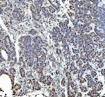 Anti-P15RS/RPRD1A Antibody