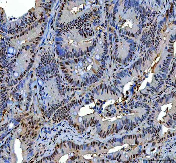 Anti-P15RS/RPRD1A Antibody