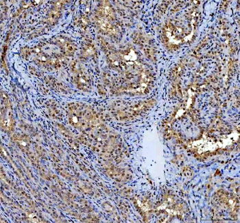 Anti-P15RS/RPRD1A Antibody