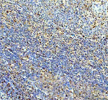 Anti-P15RS/RPRD1A Antibody