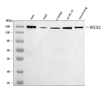 Anti-ROCK2 Antibody