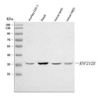 Anti-RNF212B Antibody