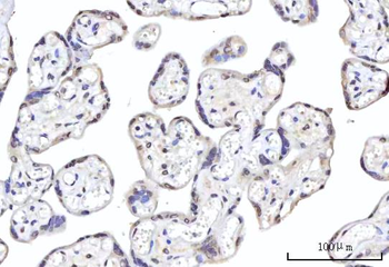 Anti-RBM22 Antibody