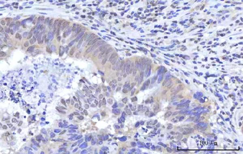 Anti-RBM22 Antibody