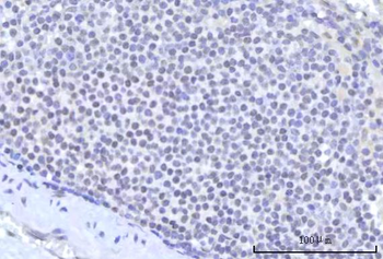 Anti-RBM22 Antibody
