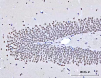 Anti-RBM22 Antibody