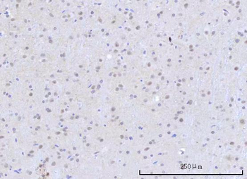 Anti-RBM22 Antibody