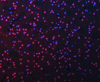 Anti-RBM22 Antibody