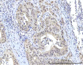 Anti-RBM22 Antibody
