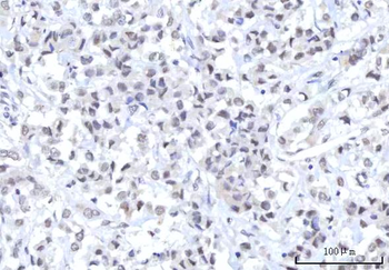 Anti-RBM22 Antibody