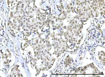 Anti-RBM22 Antibody