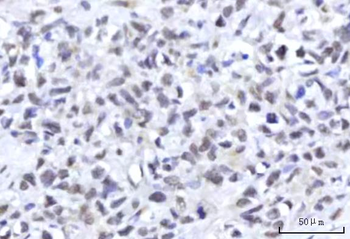 Anti-RBM22 Antibody