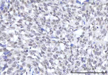 Anti-RBM22 Antibody