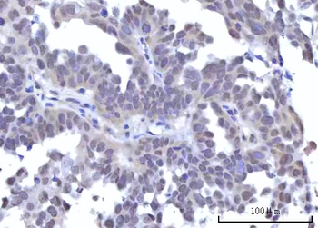 Anti-RBM22 Antibody