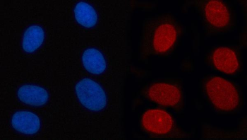 Anti-RANBP2 Antibody