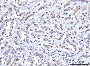 Anti-RANBP2 Antibody