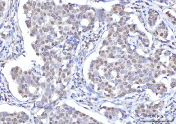 Anti-RANBP2 Antibody