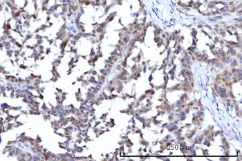 Anti-RANBP2 Antibody