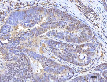 Anti-RANBP2 Antibody