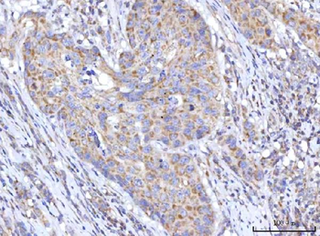 Anti-C18orf22/RBFA Antibody