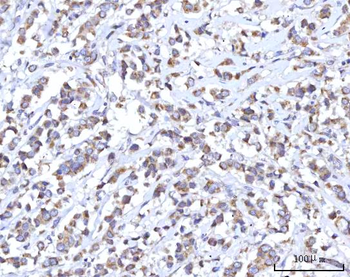 Anti-C18orf22/RBFA Antibody