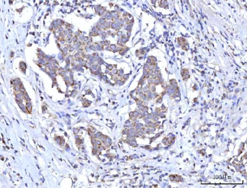 Anti-C18orf22/RBFA Antibody