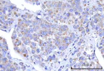 Anti-C18orf22/RBFA Antibody