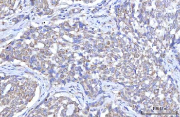 Anti-C18orf22/RBFA Antibody