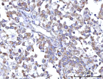 Anti-C18orf22/RBFA Antibody