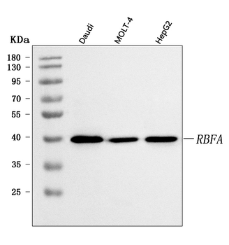 Anti-C18orf22/RBFA Antibody