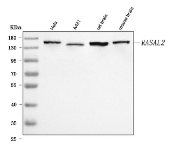 Anti-RASAL2 Antibody