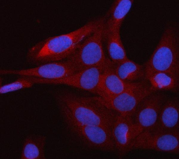 Anti-RAP1GDS1 Antibody