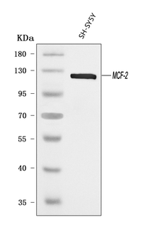 Anti-DBL Antibody