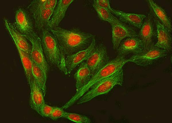 Anti-RFX3 Antibody