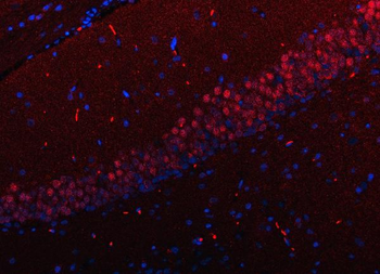 Anti-RFX3 Antibody