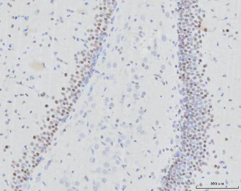 Anti-RFX3 Antibody