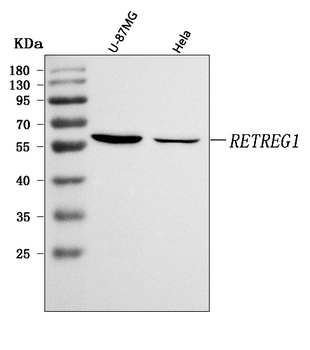 Anti-RETREG1 Antibody