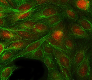 Anti-RBP1 Antibody