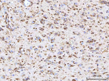 Anti-RBP1 Antibody