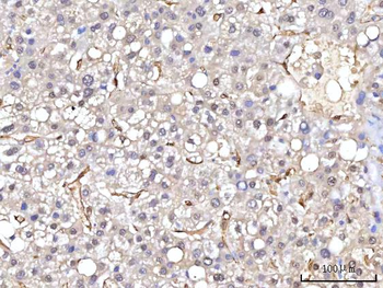 Anti-RBP1 Antibody