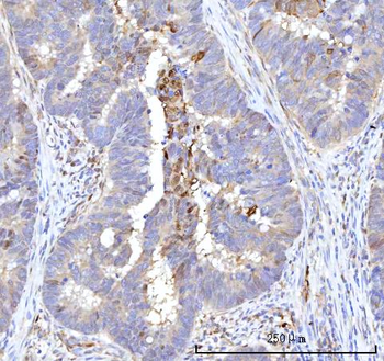 Anti-RBP1 Antibody