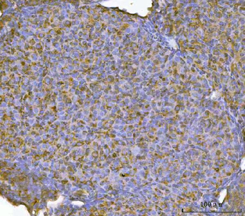 Anti-RBP1 Antibody