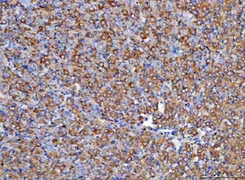 Anti-RBP1 Antibody
