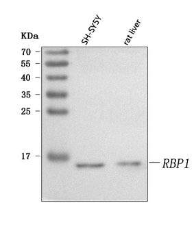 Anti-RBP1 Antibody