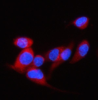 Anti-P97/DAP5/EIF4G2 Antibody