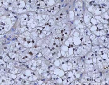 Anti-RAD51C Antibody