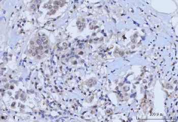 Anti-RAD51C Antibody